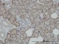 ITM1 Antibody (monoclonal) (M02)